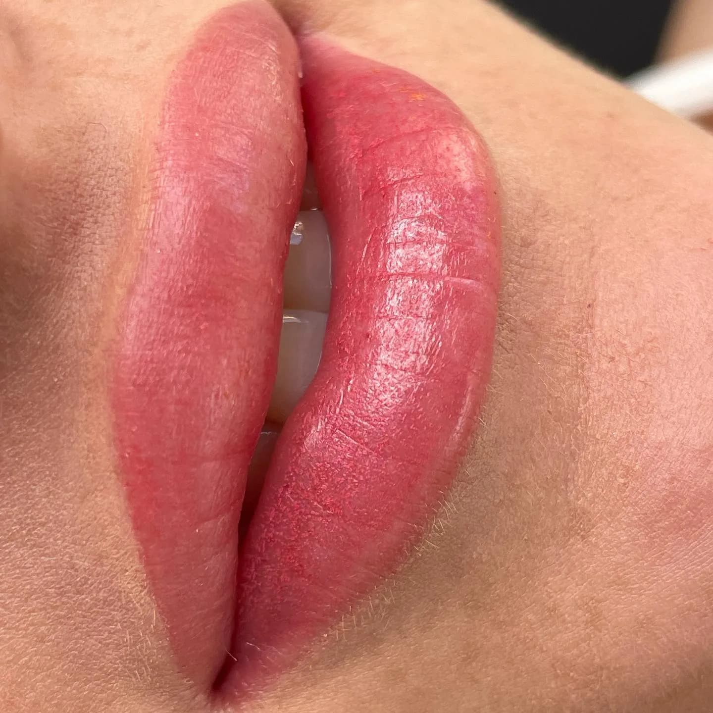Resultado de labios efecto natural