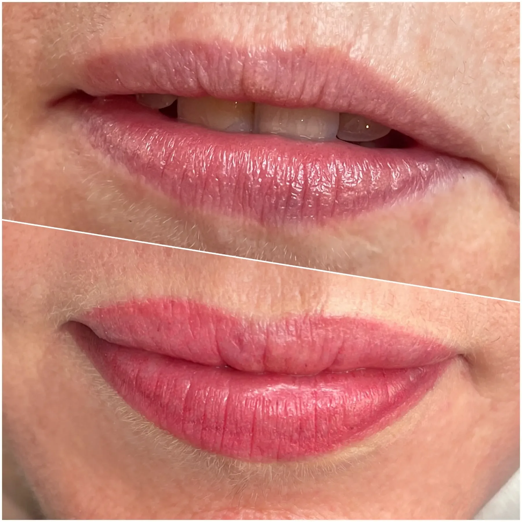 Resultado de micropigmentación de labios efecto natural